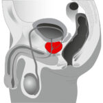 Mystim Twisting Tom Silikone Prostata Plug