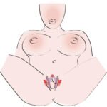 Intimate Spreader G-Punkt Stimulator