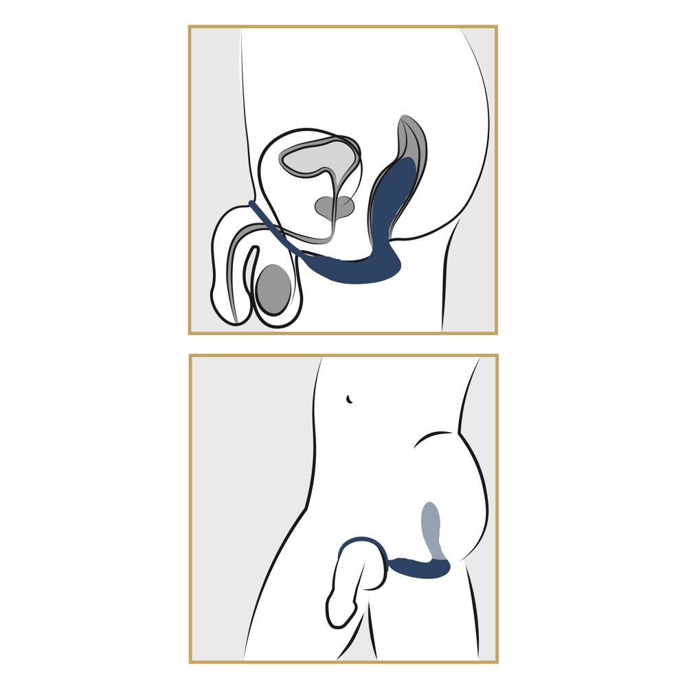 prostata-anal-vibrator-med-penisring-11