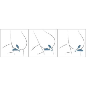 Vibepad Mini Klitoris Stimulator med Vaginal og Anal Bullet Vibrator