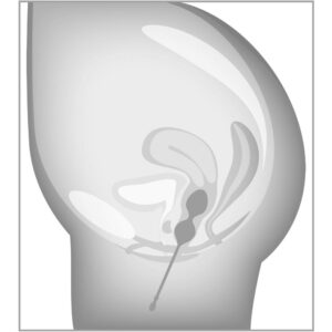 Beau Coeur ELORIN Loveball Bækkenbundskugler Træningssæt