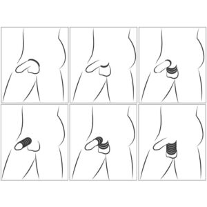 Silikone Cock & Ball Stretching Sæt